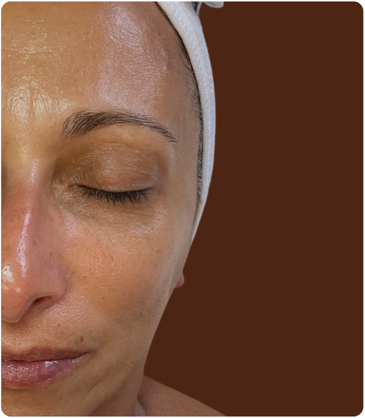 Après traitement Sculptface