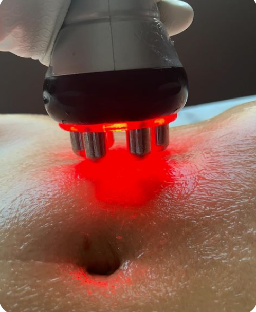Drainage Lymph. 1